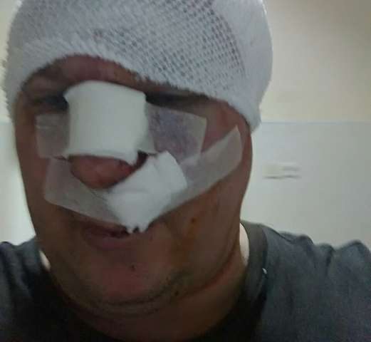 Жорстоко побили догхантера, який вбивав собак (+фото) 