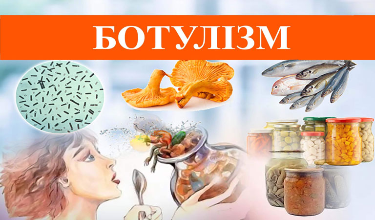 Три випадки захворювання й одну смерть від ботулізму зареєстровано на Київщині 