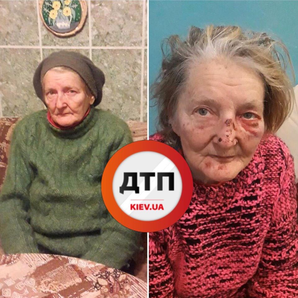 Пропалу жінку непотомною знайшли у лісі 